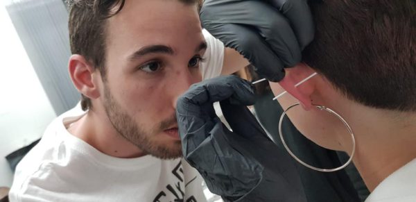 Es Normal Tener Pus En El Piercing De La Lengua
