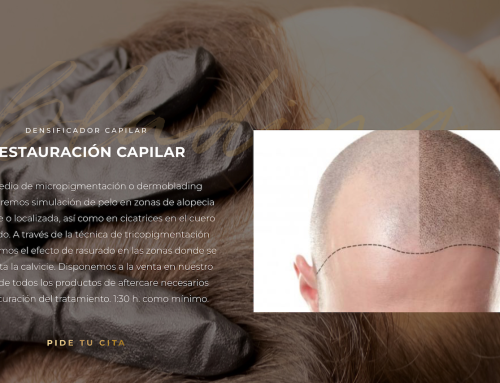 MICROPIGMENTACIÓN CAPILAR EN EL CENTRO DE MADRID